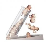 乐芮和果纳芬一起促排，试管婴儿能筛选性别吗？